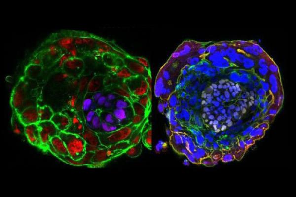 科学家打破人类胚胎体外培育时间记录，“14天规